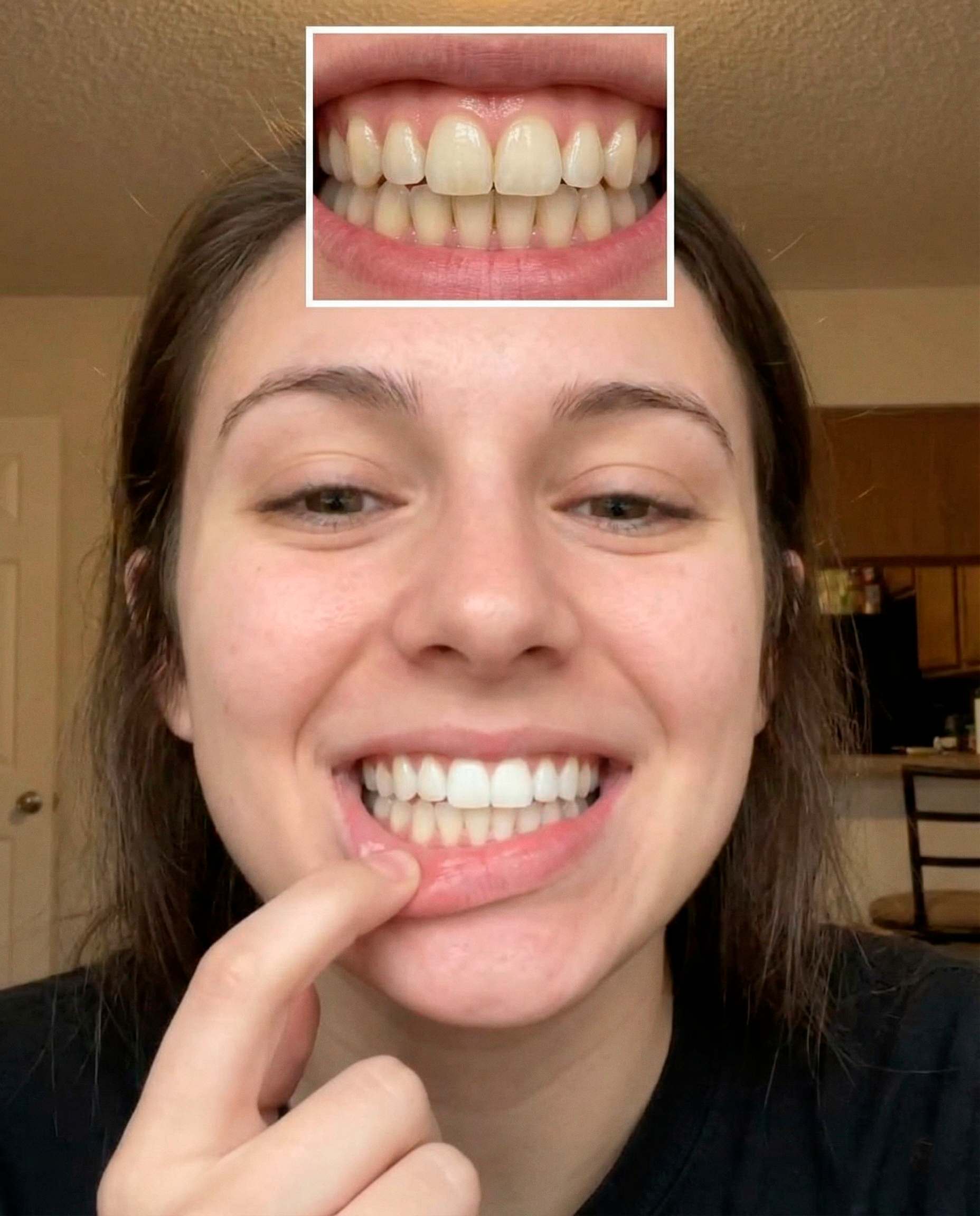 Goodbye yellow teeth